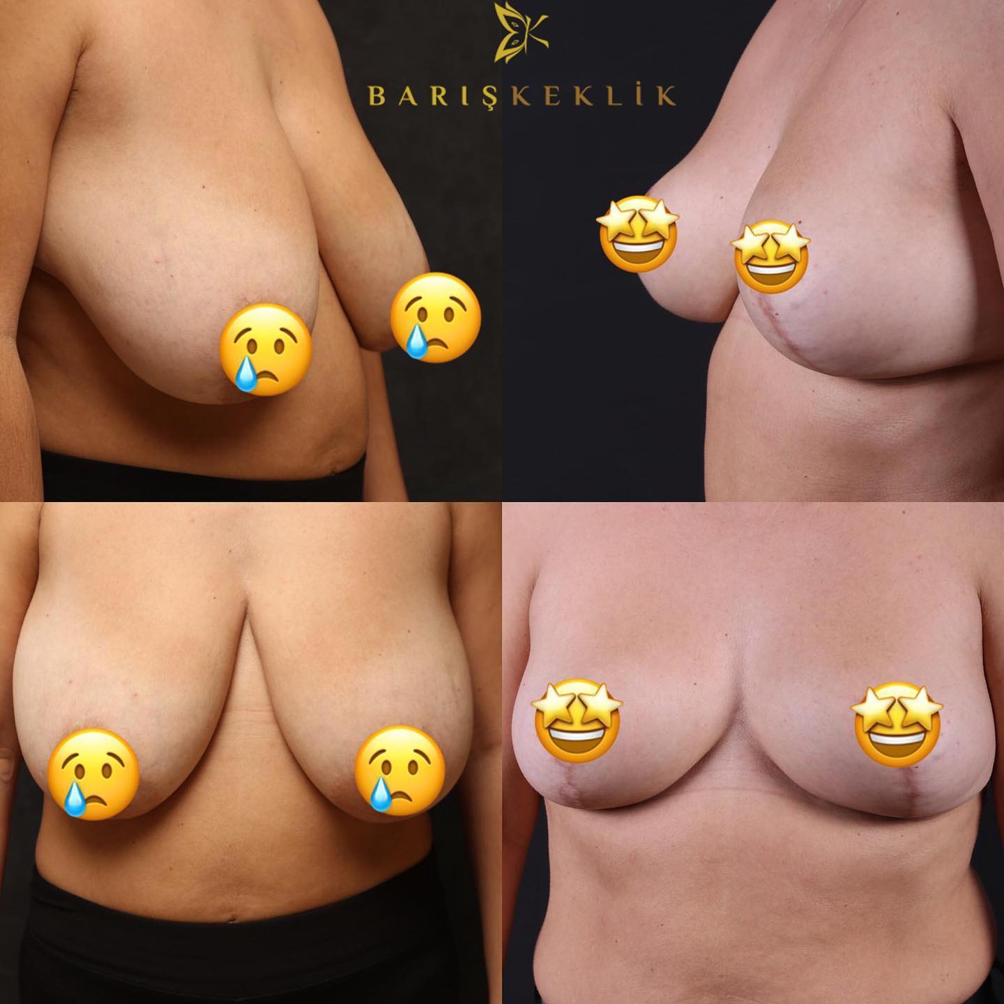 before-after