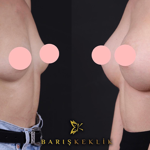 before-after
